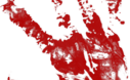 Blood-hand-smear-psd17414